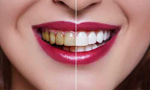 Cirugía Maxilofacial en La Serena